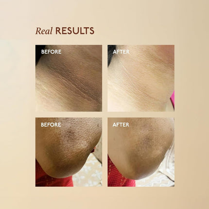 Asaya Tone Restore | Advanced Pigmentation Cream with MelaMe™ Complex | 50g