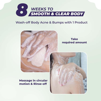 Sanfe Dark Spots & Acne Clearing Body Soap-75g