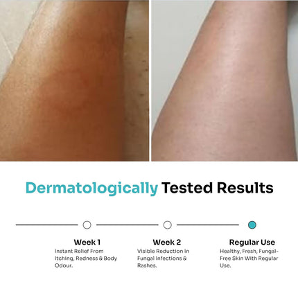 Kitcoz Anti Fungal Body Wash For Men & Women with Tea Tree Oil -300ml