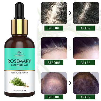 INTIMIFY Rosemary Essential Oil For Hair Growth for Women & Men-30ml