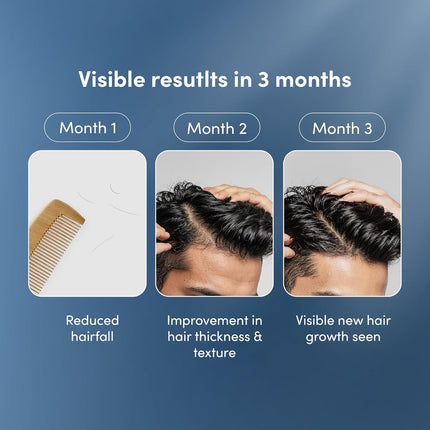 Man Matters Advanced Hair Serum 30ml | 23% actives (3% Redensyl, 2% Anagain & 1% Aminexil, Rosemary Leaf Extract)