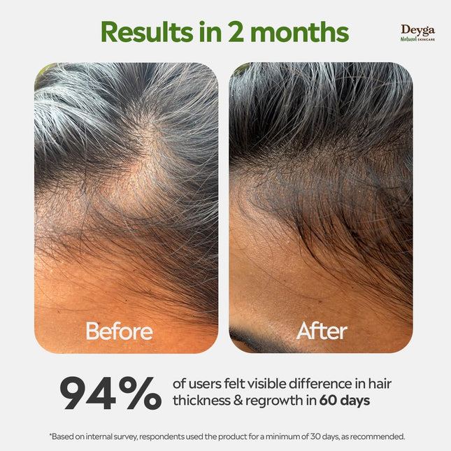 Deyga Hair Growth Oil With Hibiscus, Rosemary & Bhringaraj (100ml)