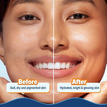 Aqualogica Glow+ Hydra Gel Moisturizer with Vitamin C & Papaya-200g