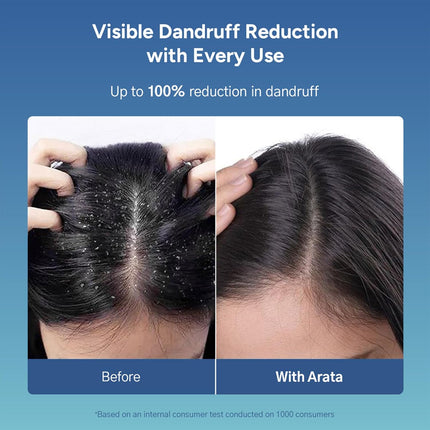 Arata Anti Dandruff Detox Duo For Normal, Oily Hair Shampoo +Conditioner 200ml