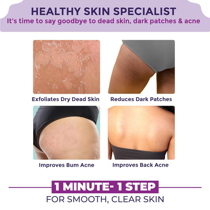 Sanfe Back & Bum Cream for Dark Spots and Body Acne | Glycolic Acid, Lactic Acid & Urea | 11% AHA-100gm