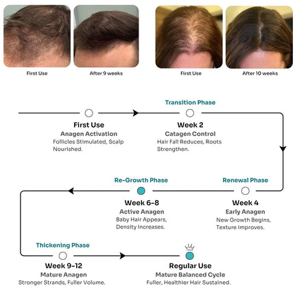 Kitcoz Advanced Hair Growth Serum Concentrate with 21% Actives | 3% Anagain, 3% Procapil, 3% Redensyl & 5% Rosemary Extract -30ml