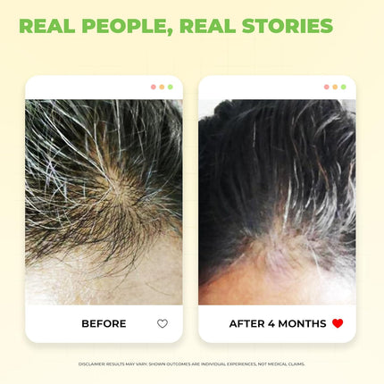 Avimee Herbal Scalptone Grey Hair Serum with Hyaluronic Acid & Caffeine For All hair types | 25 ml