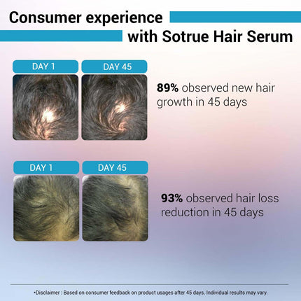 Sotrue Hair Growth Serum With 3% Redensyl For Women & Men, For All Hair Types, 30ml