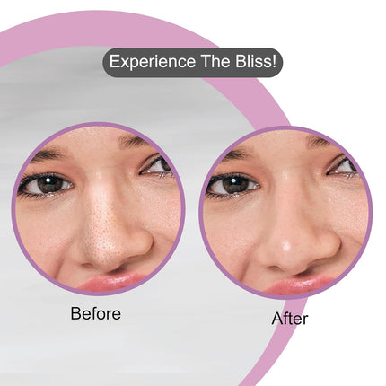 DR.RASHEL Bamboo Charcoal Nose Pore Strips -20Pcs