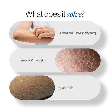 Be Bodywise 20% Urea Body Lotion 300ml