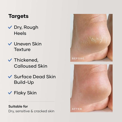 Cureskin Foot Care Cream for Cracked Heels-50 g