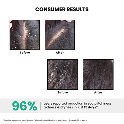 ThriveCo AHA BHA PHA Exfoliating Scalp Scrub -25ml