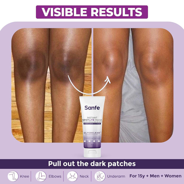 Sanfe Instant Spotlite Mask For Dark Underrams, Neck & Body-100g
