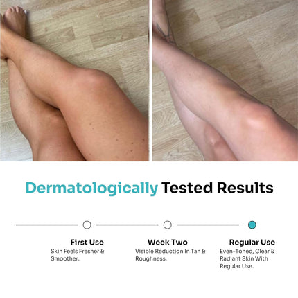 Kitcoz Detan Body Wash with 2% Glycolic Acid, 2% Kojic Acid, 2% Arbutin & 5% Niacinamide-250ml