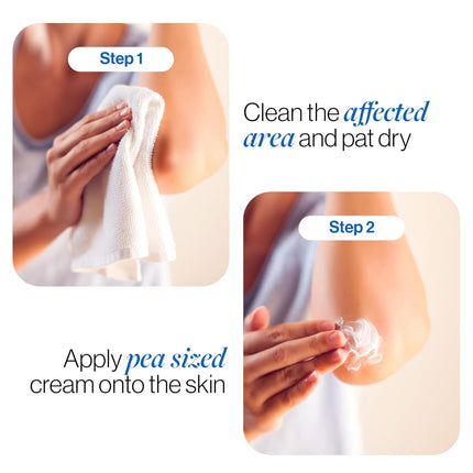 Be Bodywise Pigmentation Cream 100gm