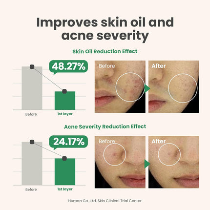 AXIS-Y Spot The Difference Blemish 4-Terpineol 2% Niacinamide AHA BHA Spot Treatment Face Serum -15ml