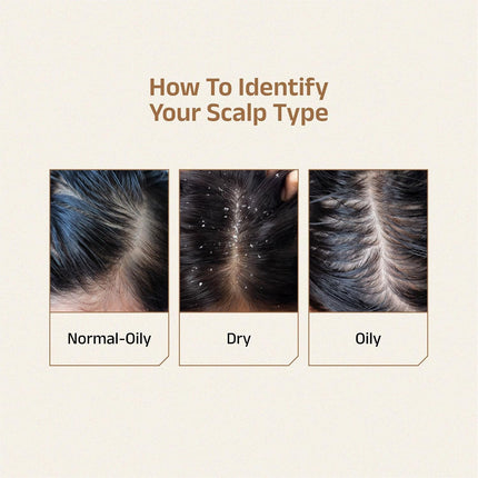 Vedix Taritha Anti Dandruff Shampoo | 100 ml