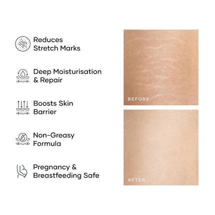 Cureskin Smoothing Body Butter Stretch Marks Cream-100G