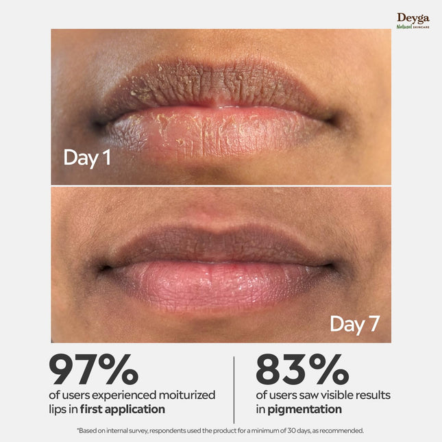 Deyga Beetroot Lip Balm For Women & Men-10g