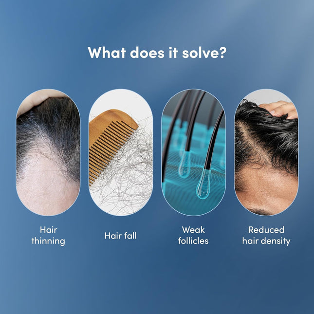 Man Matters Advanced Hair Serum 30ml | 23% actives (3% Redensyl, 2% Anagain & 1% Aminexil, Rosemary Leaf Extract)