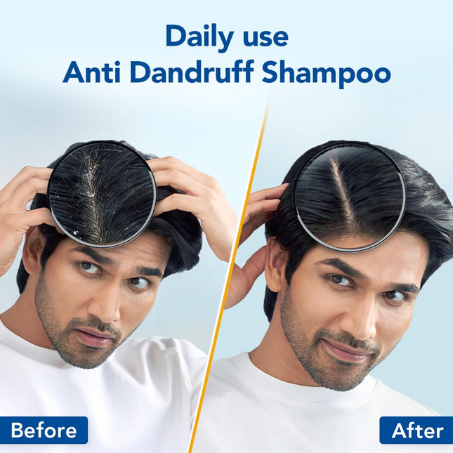 Scalpe Pro Daily Anti-Dandruff Shampoo | Removes Dandruff  For Women & Men | 200ml