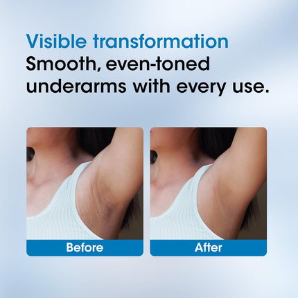 OG BEAUTY Science+ 4% AHA BHA Underarm Roll On | 2% Lactic 1% Salicylic 1% Mandelic Acid 1% Alpha-50ml