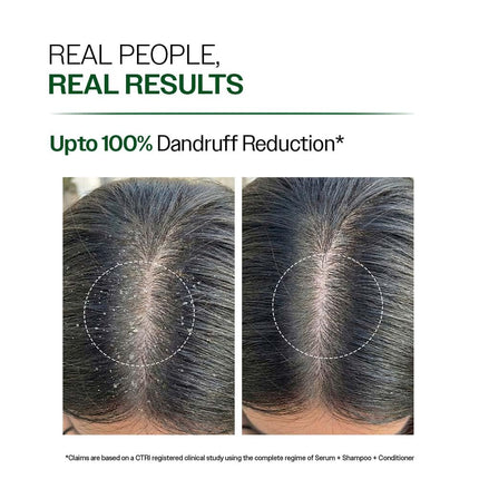 Bare Anatomy Anti-Dandruff Shampoo Unisex | 250 ml