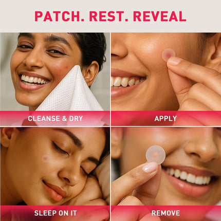 Sirona Pimple Patches – 72 Dots | 0.5% Salicylic Acid | Invisible Facial Stickers Cover
