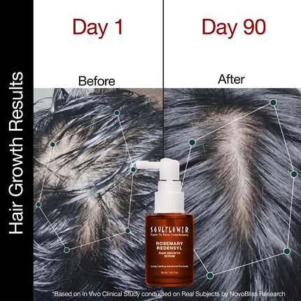 Soulflower Hair Growth Serum, Rosemary Oil, 3% Redensyl, 4% Anagain, Caffeine, Melanogray, Biotin, Rice Water - 30ml