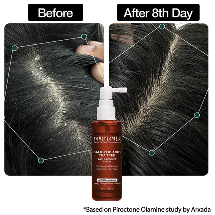 Soulflower Anti Dandruff Hair Serum with Piroctone Olamine, 2% Salicylic Acid & Rosemary Essential Oil-50ml
