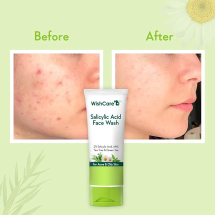 WishCare 2% Salicylic Acid Face Wash-100ml