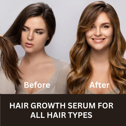 INTIMIFY Hair Growth Serum for Men and Women-30ml