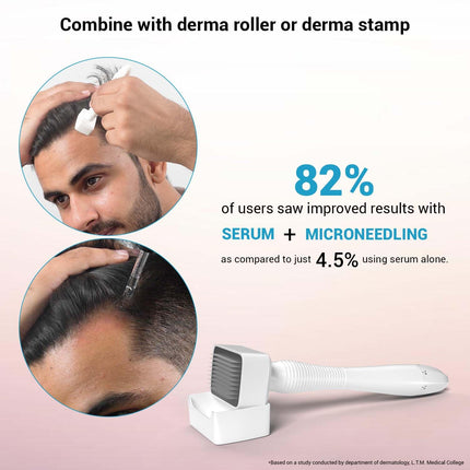 Sotrue Hair Growth Serum With 3% Redensyl For Women & Men, For All Hair Types, 30ml