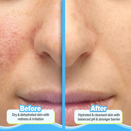 Aqualogica 5 Barrier+Repair Gentle Face Cleanser With Avocado&5 Essential Ceramides-100Ml