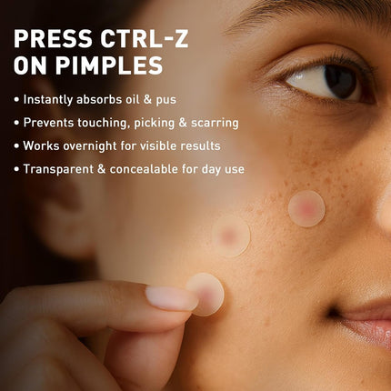 Sirona Pimple Patches – 72 Dots | 0.5% Salicylic Acid | Invisible Facial Stickers Cover