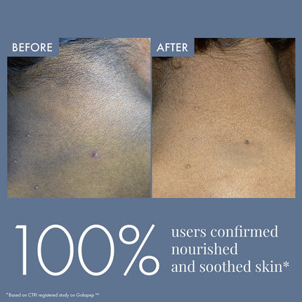 ThriveCo Dark Patches Corrector Cream -100ml