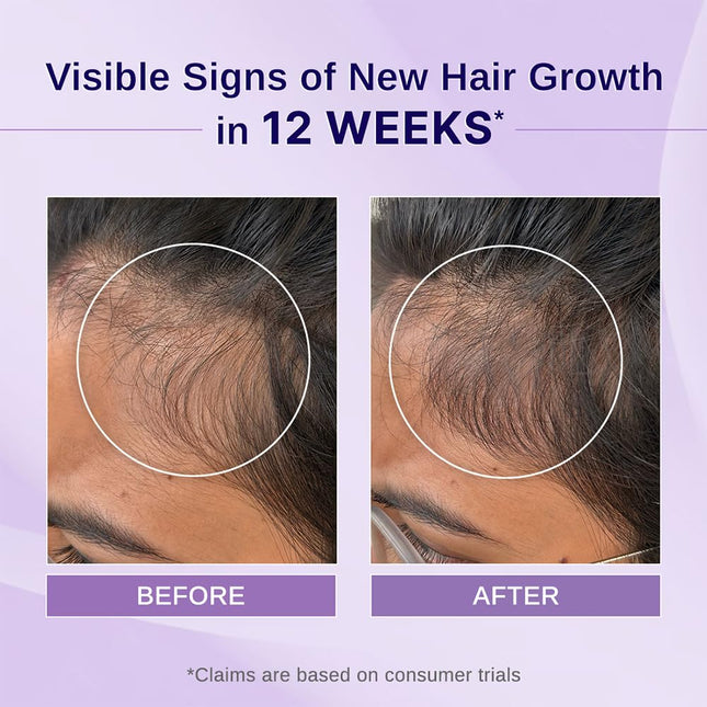 Bare Anatomy Nature x Science Rosemary Hibiscus Hair Growth Oil-100ml