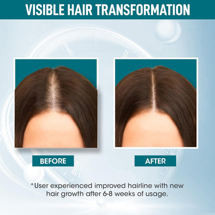 OG BEAUTY Science+ Hair Growth Serum 30ml - 5% Capixyl, 3% Procapil, 2% Redensyl, 0.5% Biotin | Enriched with Caffeine