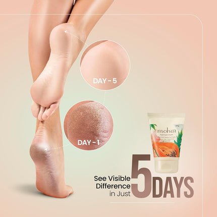 Moha Foot Cream for Dry & Cracked Feet-100gm