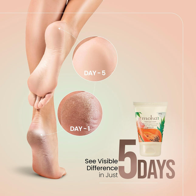 Moha Foot Cream for Dry & Cracked Feet-100gm