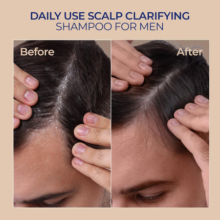 Naturali Scalp Clarifying Anti-Dandruff Shampoo -200ml