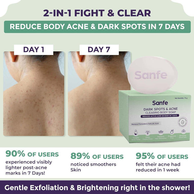 Sanfe Dark Spots & Acne Clearing Body Soap-75g