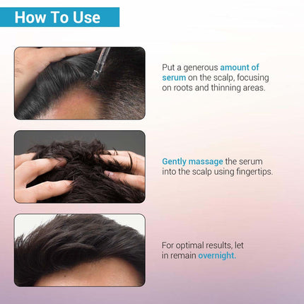 Sotrue Hair Growth Serum With 3% Redensyl For Women & Men, For All Hair Types, 30ml