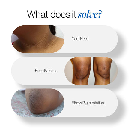 Be Bodywise Pigmentation Cream 100gm