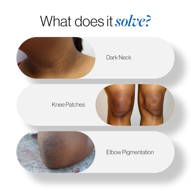 Be Bodywise Pigmentation Cream 100gm