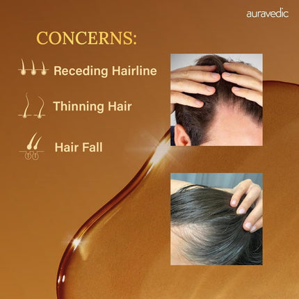 Auravedic Rosemary Hair Oil For Hair Growth -100 Ml