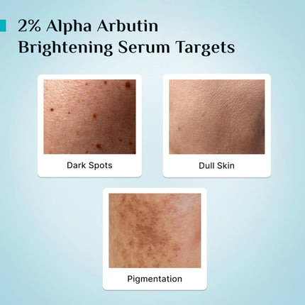 PILGRIM Korean 2% Alpha Arbutin & 3% Vitamin C Face Serum- 30ml