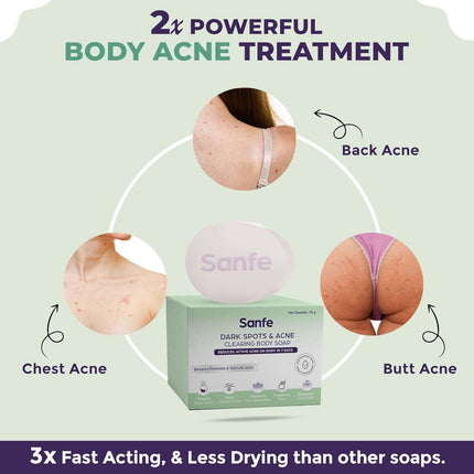 Sanfe Dark Spots & Acne Clearing Body Soap-75g