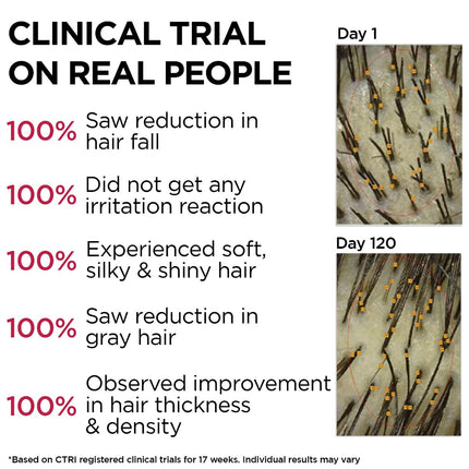 Soulflower Hair Growth Serum, Rosemary Oil, 3% Redensyl, 4% Anagain, Caffeine, Melanogray, Biotin, Rice Water - 30ml