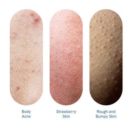 Be Bodywise 1% Salicylic Acid Body Wash 375 ml